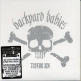 BACKYARD BABIES