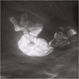 PHOEBE LOU ALICE PHOEBE LOU ALICE