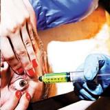 RACEBANNON RACEBANNON