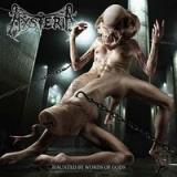 HYSTERIA
