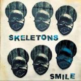 SKELETONS
