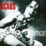 SCABS