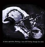 PREMATURE EJACULATION