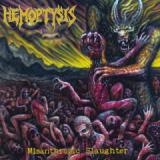 HEMOPTYSIS HEMOPTYSIS
