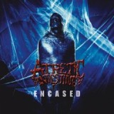 ATRETIC INTESTINE ATRETIC INTESTINE