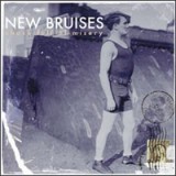 NEW BRUISES