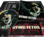 DYING FETUS