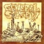 GENERAL SURGERY