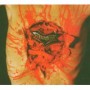 DISMEMBER