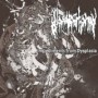 GLOSSECTOMY GLOSSECTOMY