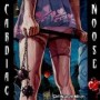 CARDIAC NOOSE